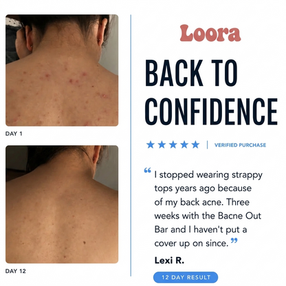 Your Back Isn't Your Face. Stop Treating It Like One.