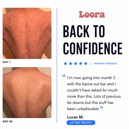 Your Back Isn't Your Face. Stop Treating It Like One.